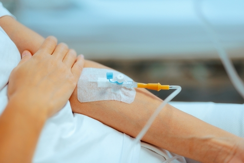 Arm with IV sedation
